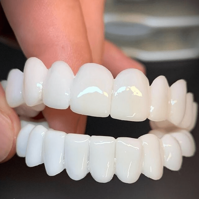 Adjustable White Dental Veneer Prosthesis — Reusable Smile 1